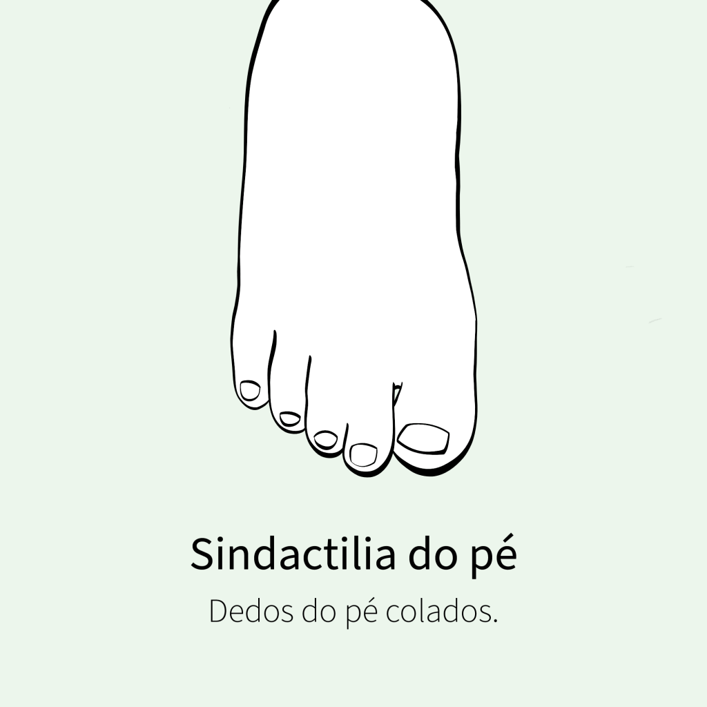 Dedos do pé colados.